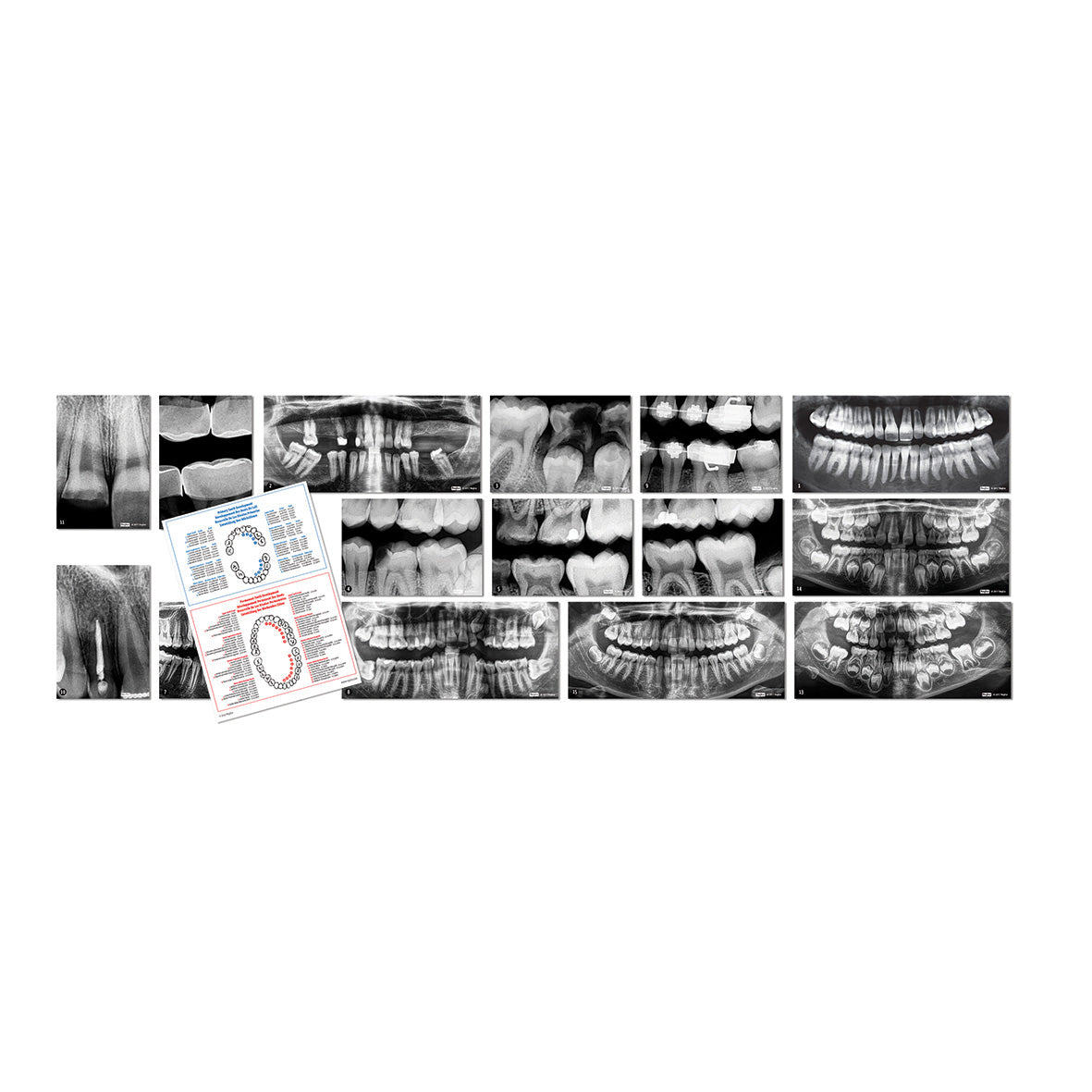 Dental X-Rays pk 15
