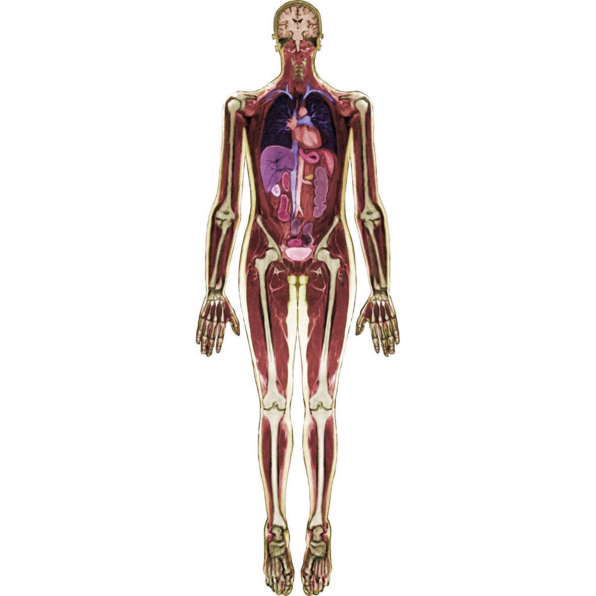 Look Inside Me: MRI Scan