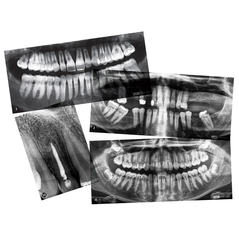 Dental X-Rays pk 15